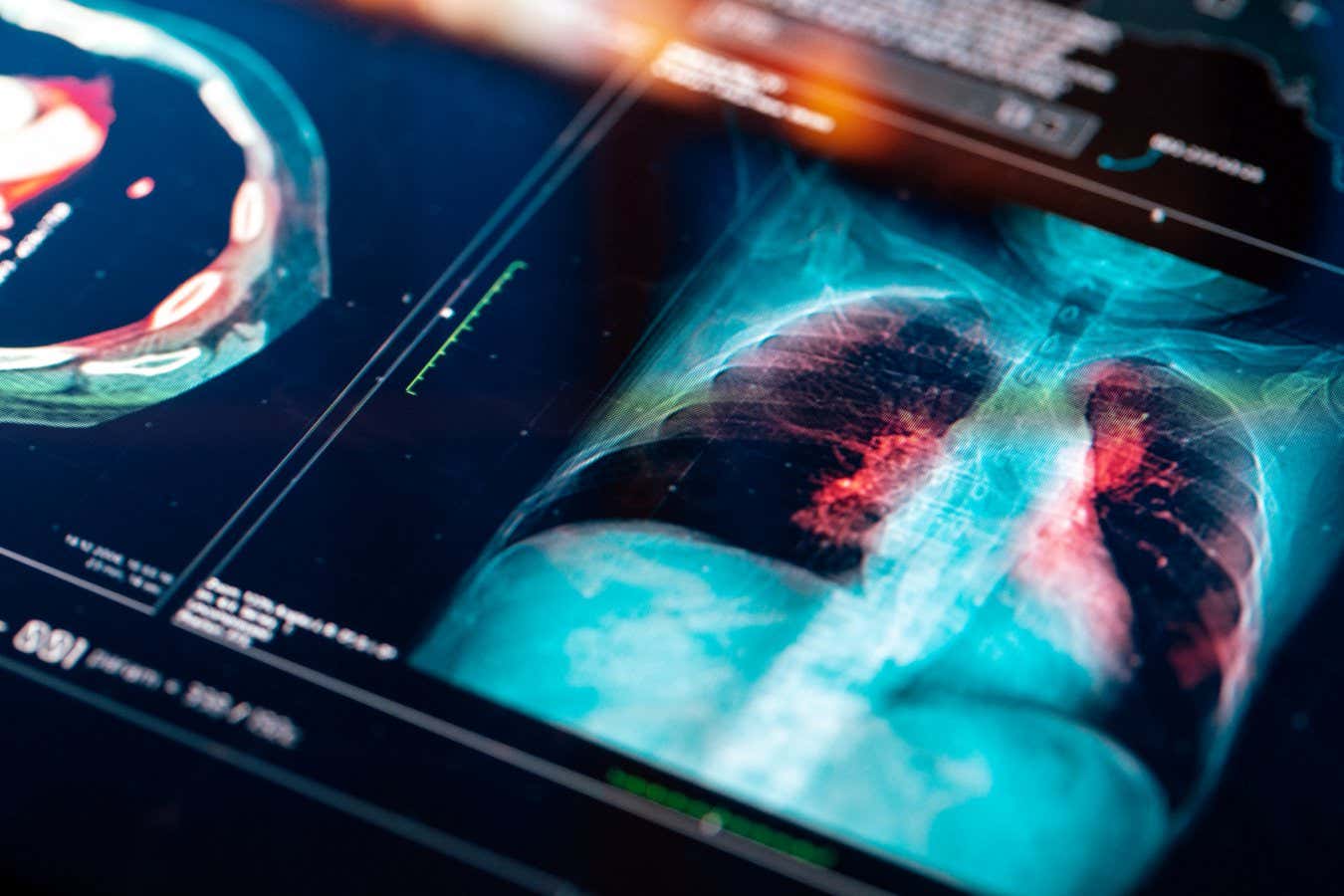 AI doesn’t know ‘no’ – and that’s a huge problem for medical bots