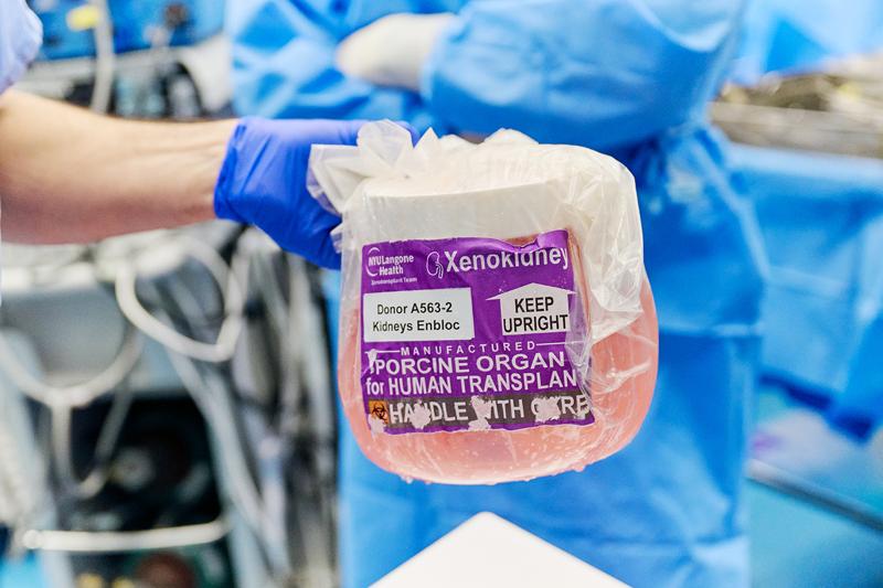 Can gene-edited pigs solve the organ transplant shortage?