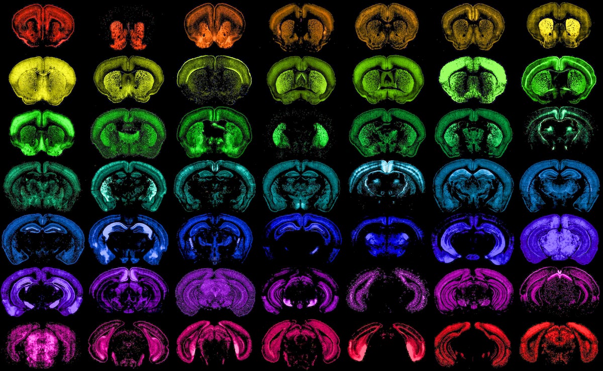 Engineered Viruses Are Transforming Neuroscience and Treating Brain Disease