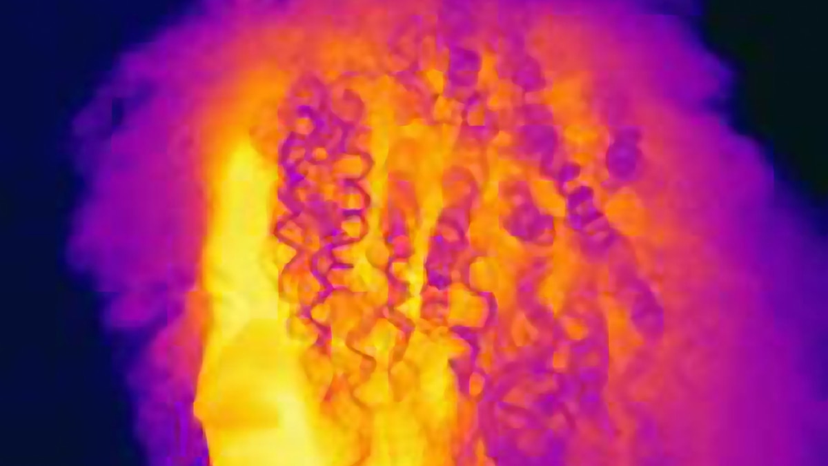 Can hypnosis really treat hot flashes?