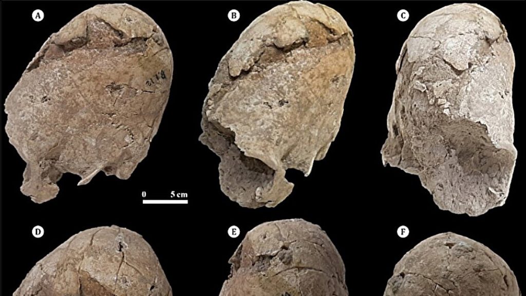 Ancient cone-shaped skull shows signs of fatal trauma