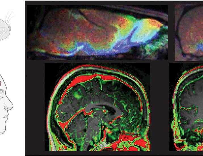 Glymphatic dysfunction in Alzheimer’s disease: A critical appraisal | Science