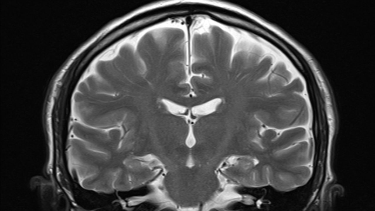 A single MRI can reveal how quickly you’re aging, scientists claim