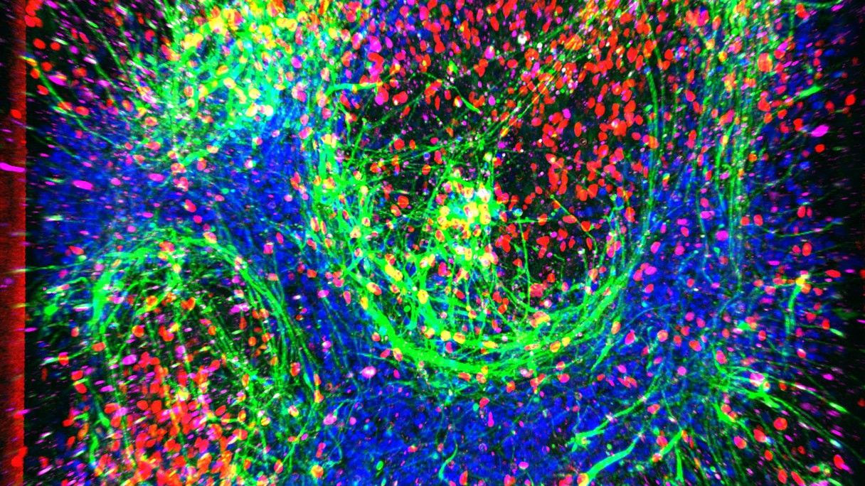 New pocket-size model of ALS ‘breathes and flows like human tissue’