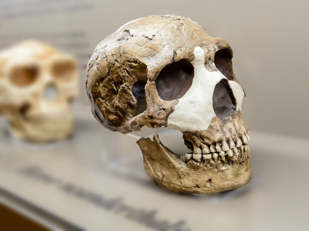 Neanderthal Genes May Cause a Rare Brain Condition That Impacts Balance and Posture