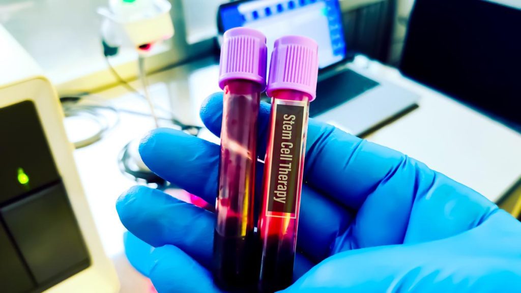Hyderabad Startup Achieves Milestone with Stem Cell Therapy for Liver Failure