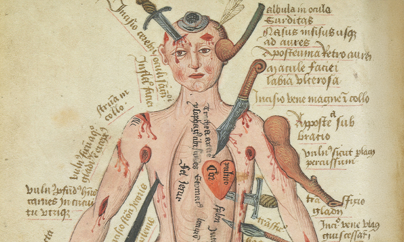 The Tortured Paths of the Wound Man