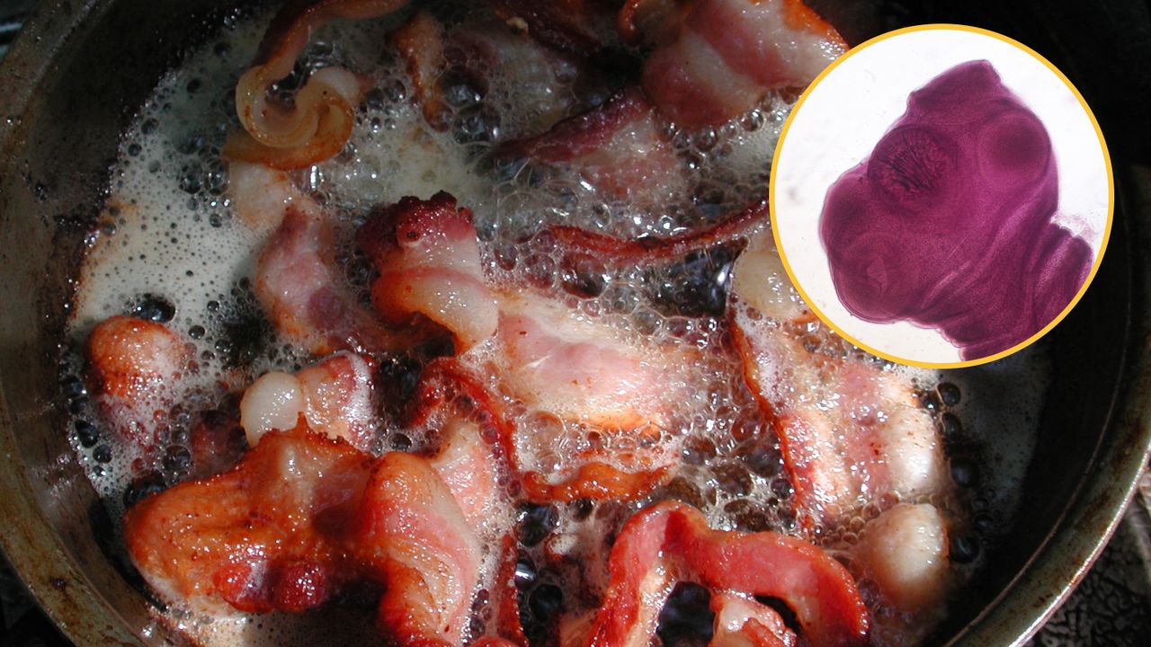 Diagnostic dilemma: A man’s preference for ‘soft’ bacon may have given him brain worms