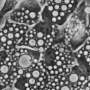 Q&A: Study reveals how cellular waste disposal system deals with stress