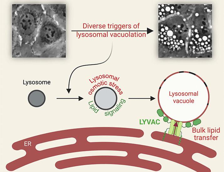 LYVAC/PDZD8 is a lysosomal vacuolator | Science