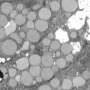 Cells ‘vomit’ waste to promote healing, but it comes with a trade-off