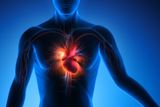 Bacterial Infections Play a Crucial Role in Heart Attacks and May Be Prevented Through Vaccination