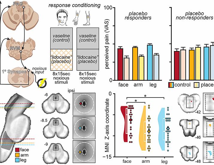 Somatotopic organization of brainstem analgesic circuitry | Science