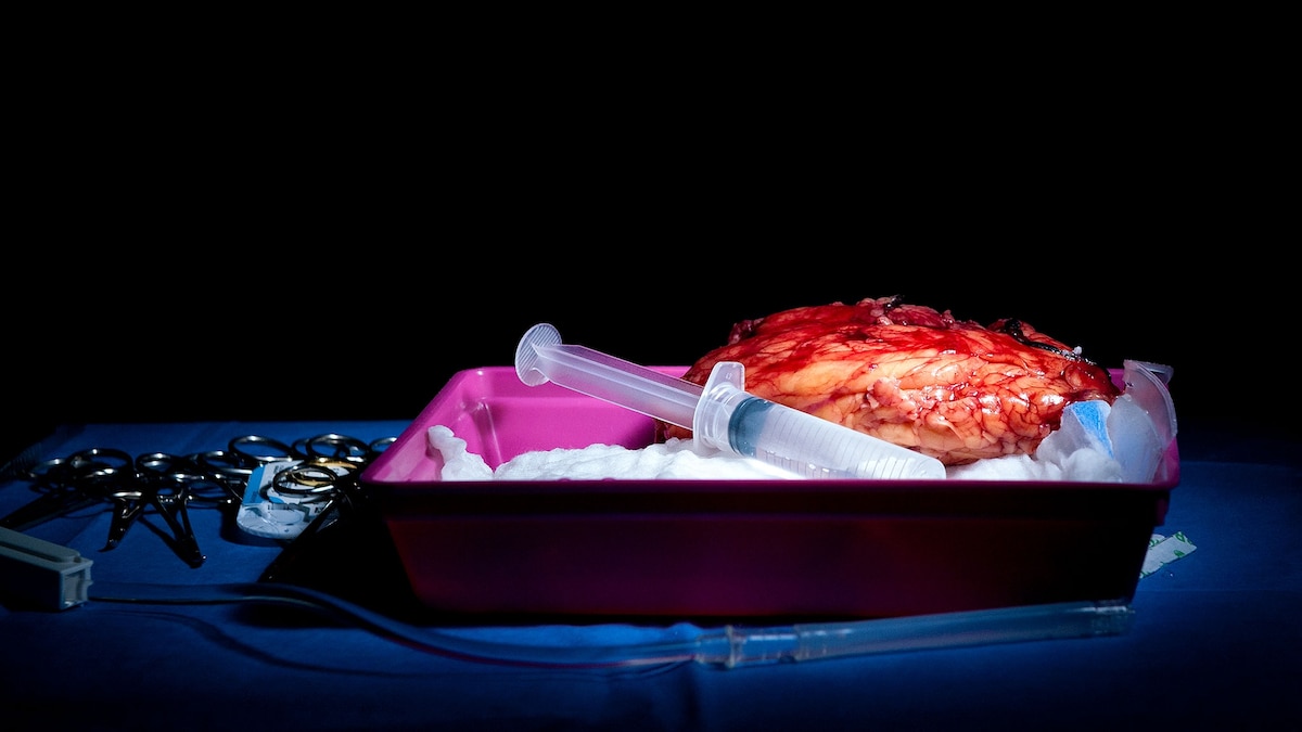 Could organ transplants really help you live to 150? Experts weigh in