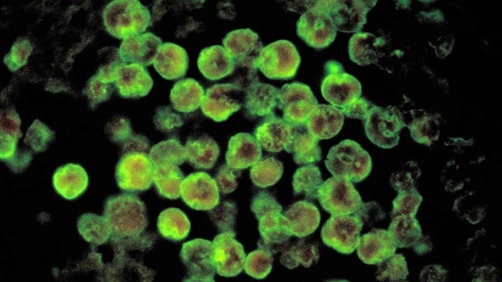 Brain-eating amoeba: Kerala reports sixth amoebic meningoencephalitis death in a month
