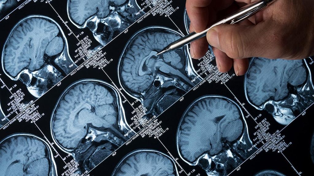 Kerala's Kozhikode Reports Fourth Recovery from Rare Brain-Eating Amoeba
