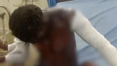 Furnace explosion at Jharkhand steel plant injures nine workers
