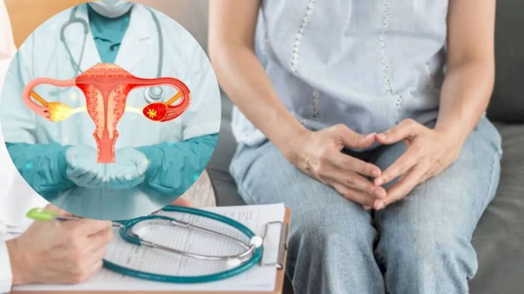 Persistent Perimenopause Symptoms May Need Ovarian Cancer Checks