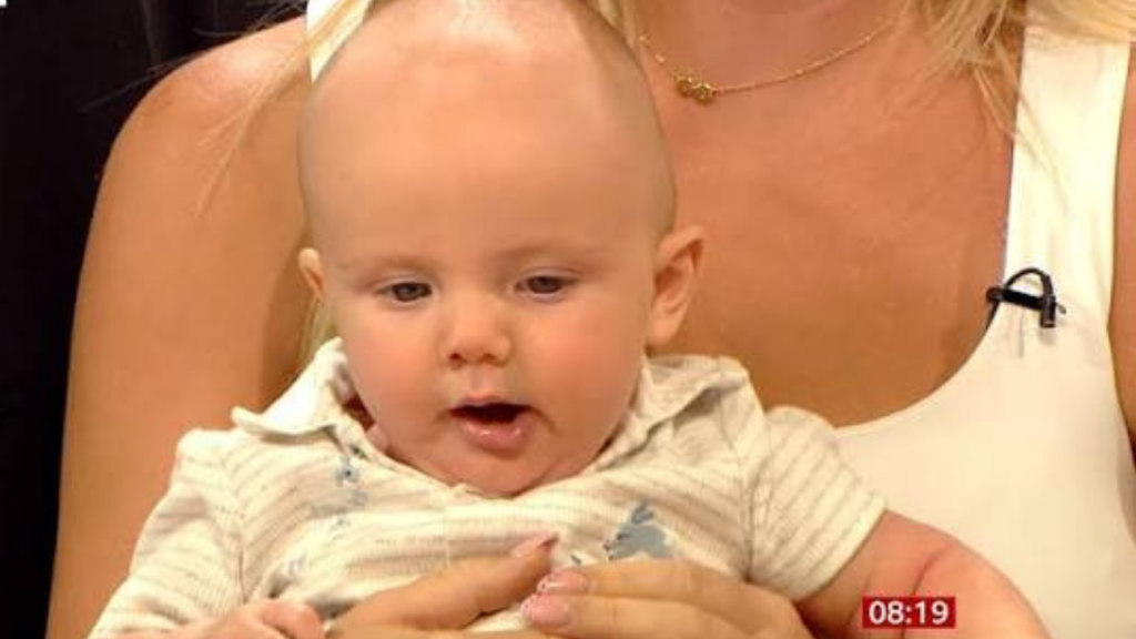 UK Baby Undergoes Experimental Gastroschisis Surgery Before Birth