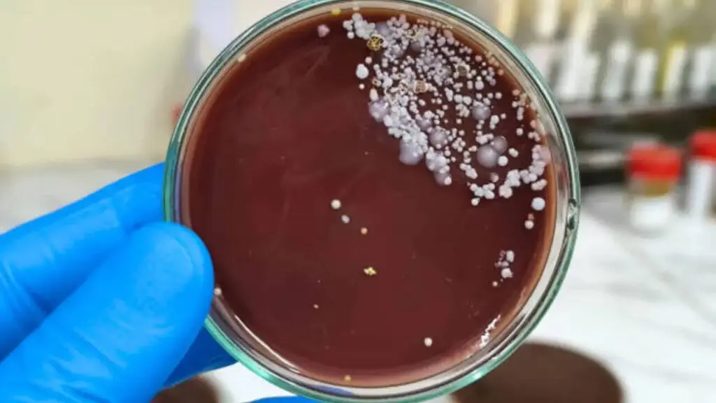 Candida auris spreads to 27 states, 3,437 cases this year