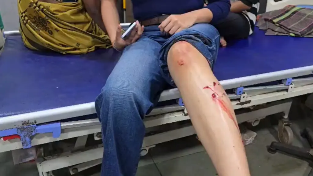 130 dog bite cases in single day in Thane's Kalyan West