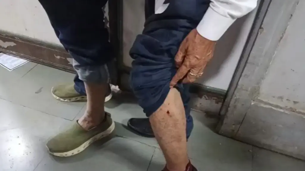 130 dog bite cases in single day in Thane's Kalyan West