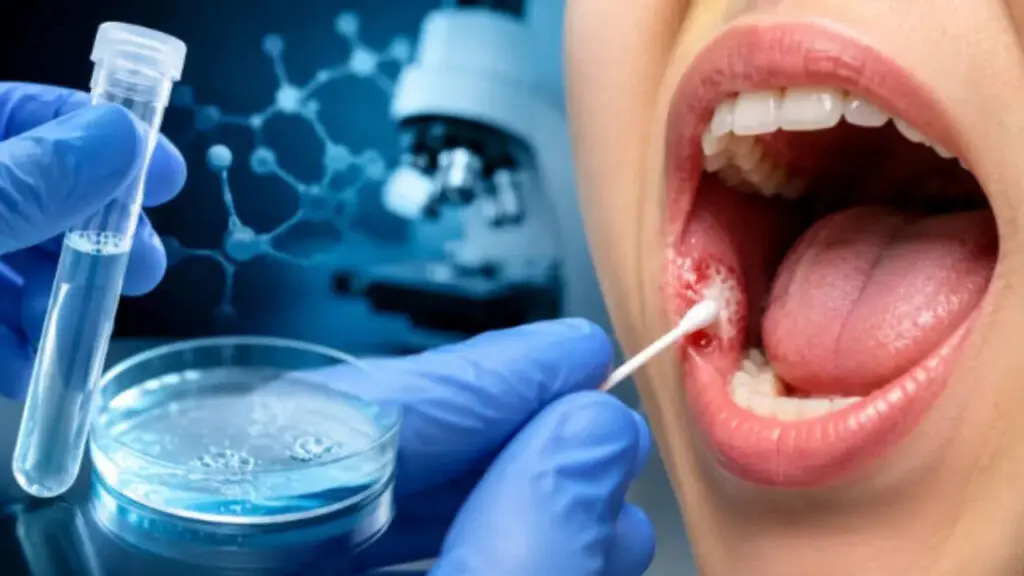 IIT Indore develops saliva test for early oral cancer detection