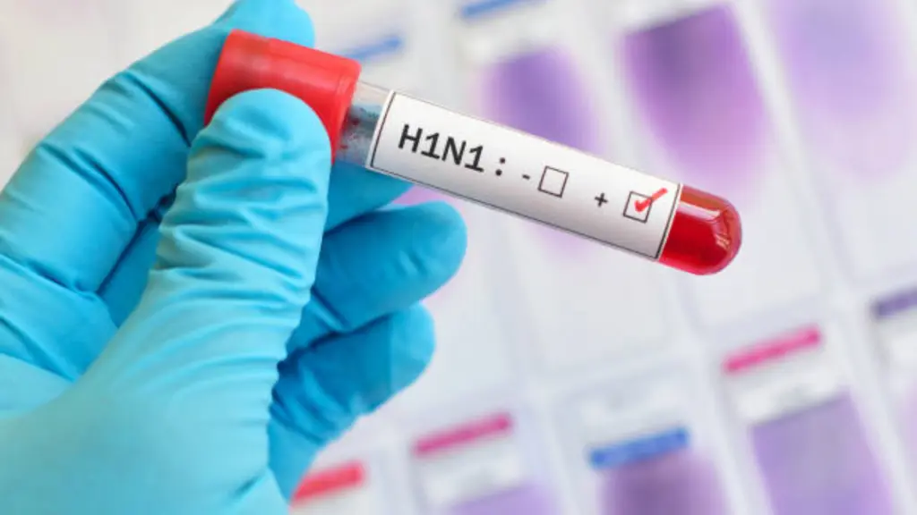 127 swine flu cases in Noida-Ghaziabad, Delhi CM calls emergency meet