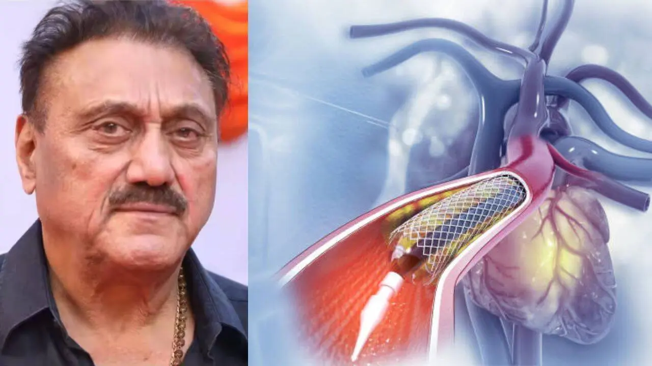 Filmmaker Kuku Kohli dies after stent, raising heart attack questions