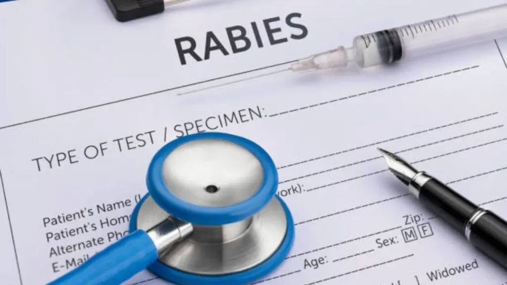 Mirzapur teen survives symptomatic rabies, doctors term it rare exception
