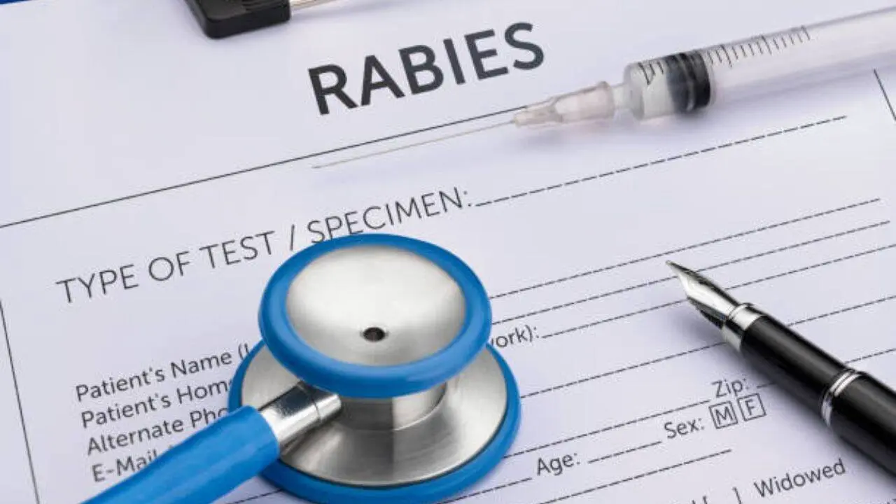 Mirzapur teen survives symptomatic rabies, doctors term it rare exception