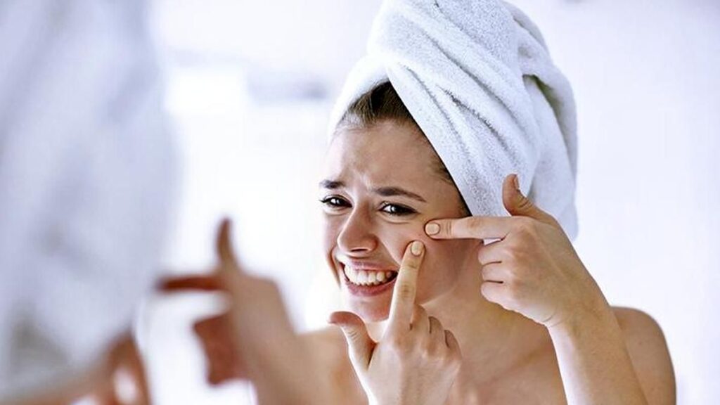 Stress Can Worsen Acne, But Rarely Causes It Alone