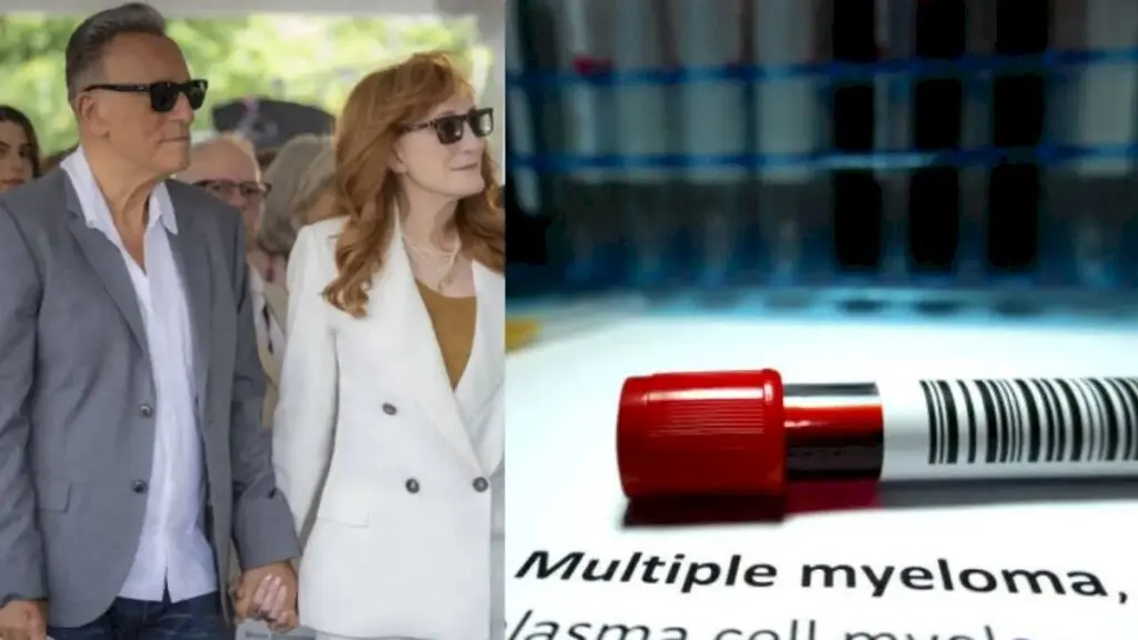 Patti Scialfa in Remission After Eight-Year Multiple Myeloma Battle