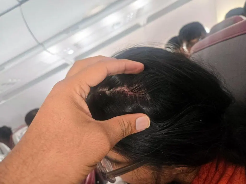 Air India A320 suffered failures; pilot failed dope test