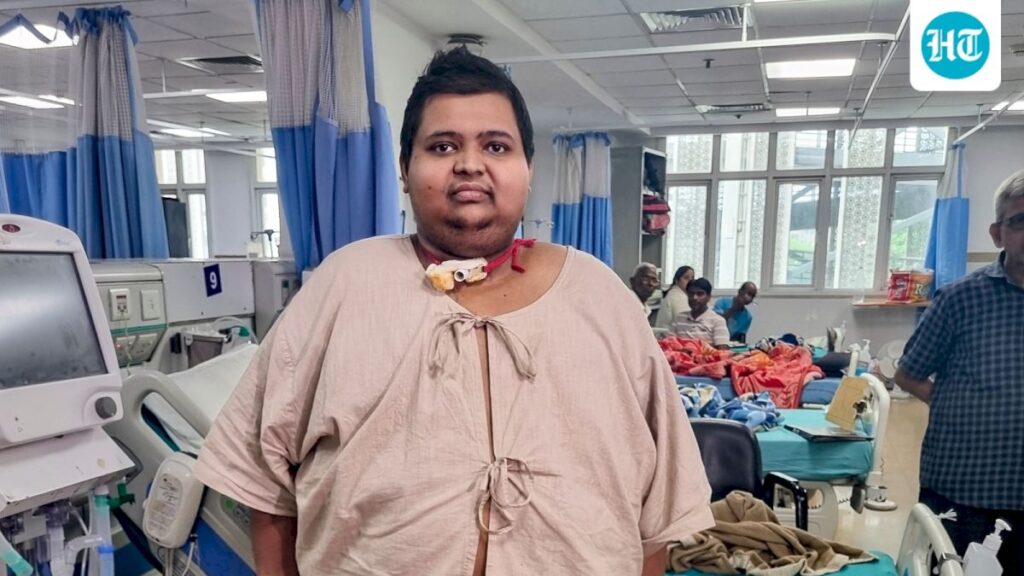 AIIMS Delhi performs bariatric surgery on 209-kg patient