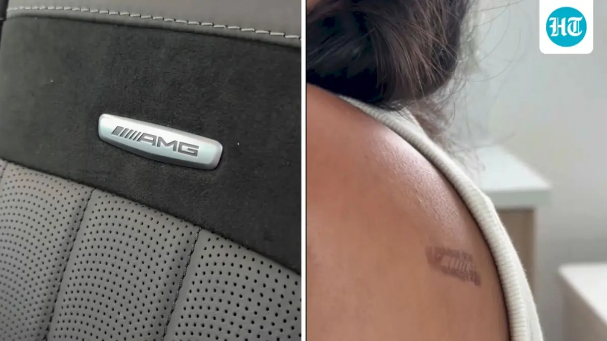 Woman sues Mercedes, says AMG logo burned her skin
