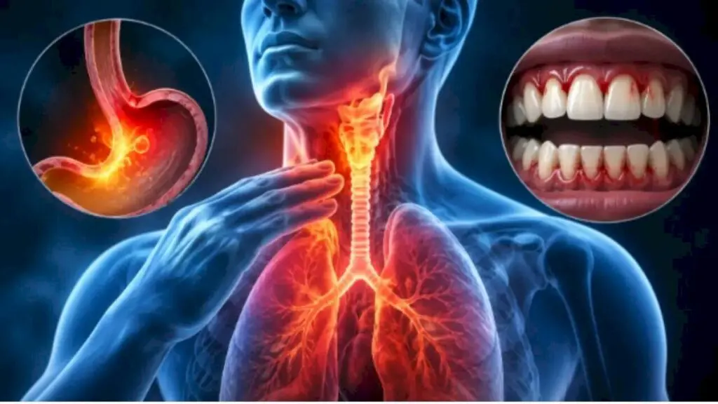 Doctor Warns Heartburn, Oral Health May Raise Cancer Risk
