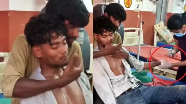 UP man gets 150 slaps, 15 venom doses to survive snake bite