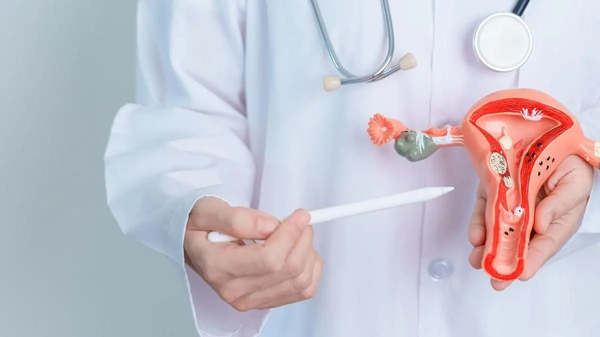 Endometriosis linked to 46% higher risk of type 2 diabetes