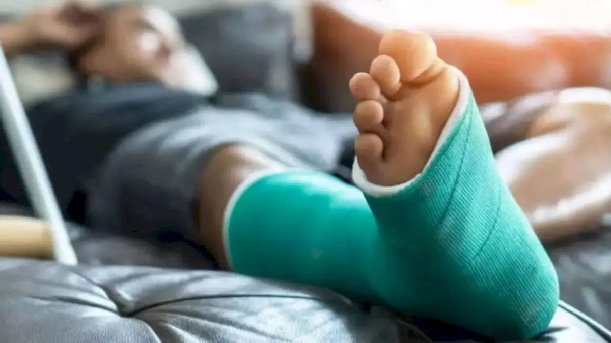 Man survives 74 days, 20 fractures after Noida accident