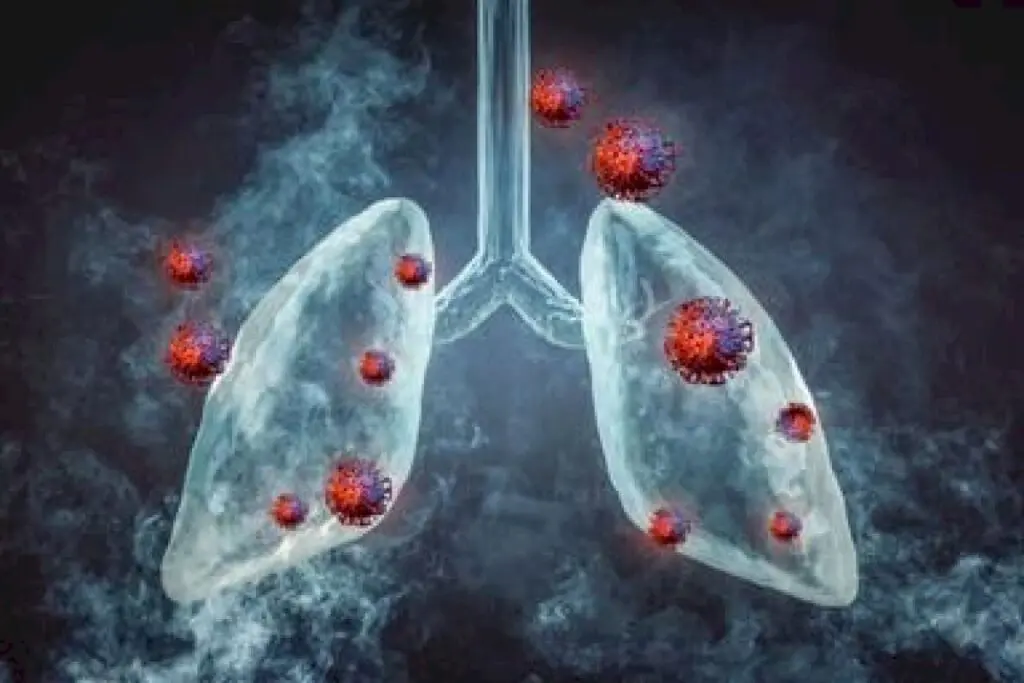 Lung cancer now a threat to non-smokers too