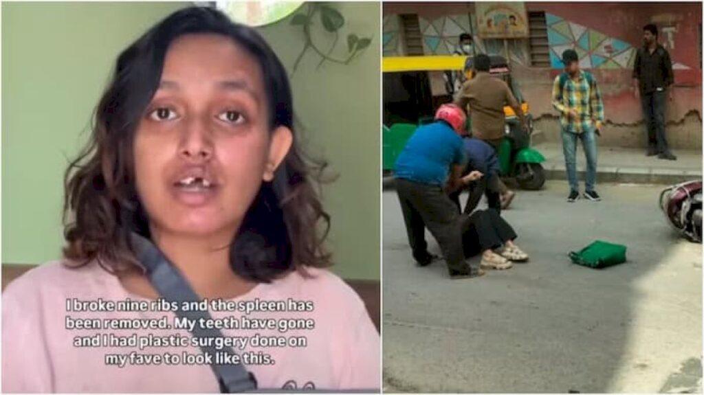Bengaluru woman to approach consumer court over Rapido accident support
