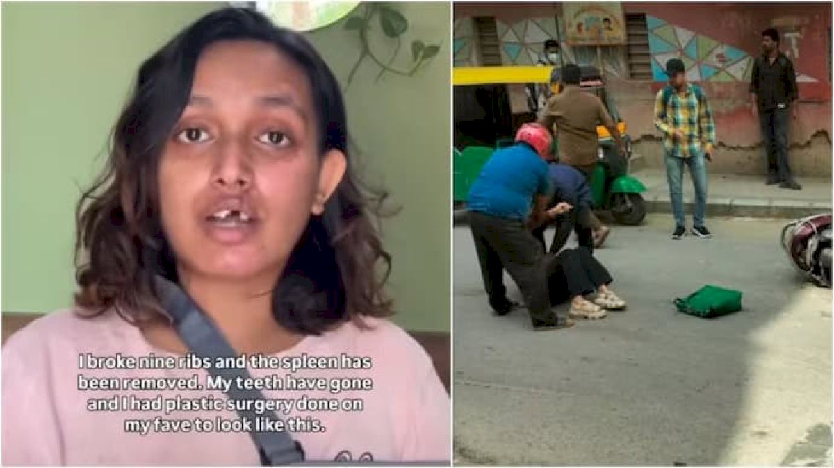 Bengaluru woman to approach consumer court over Rapido accident support