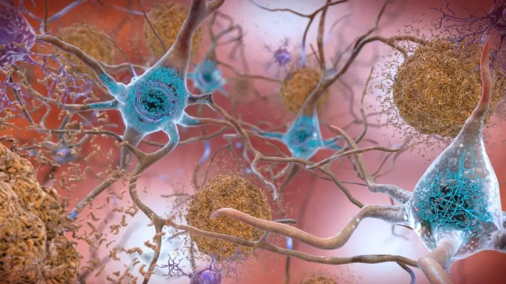 BCG vaccine may retrain immune cells to fight Alzheimer's