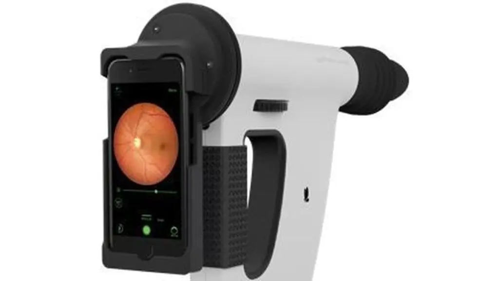 Smartphone AI system shows high accuracy in detecting eye diseases