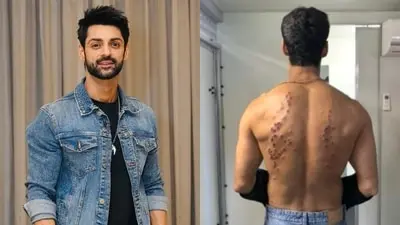 Karan Wahi says pellet gun stunt on Khatron Ke Khiladi 15 left him numb