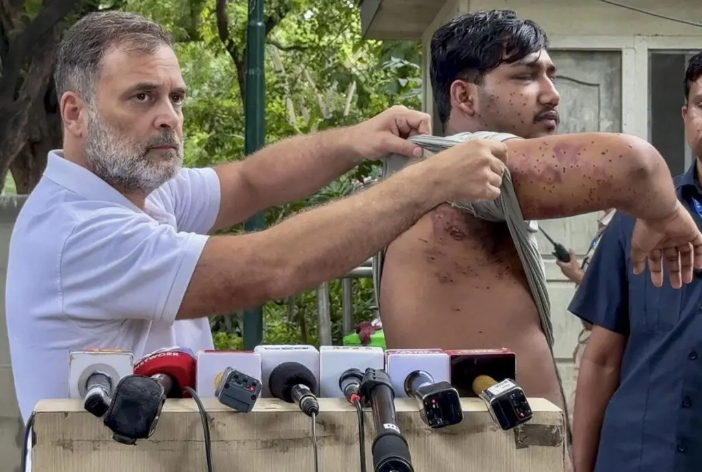 RTI data shows 10 hit by pellets in July 20 Parliament march