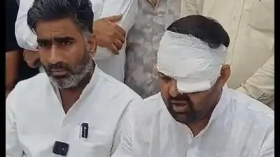 ADG orders probe into custodial torture claim in Meerut