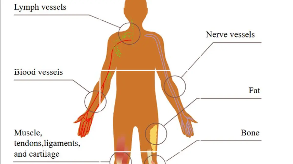 Unplanned sarcoma removals raise treatment complexity, AIIMS study finds