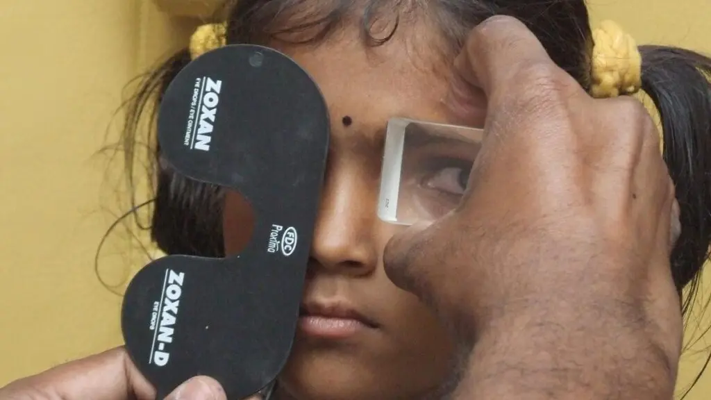 Squint eye affects 1.81% of global population, study finds